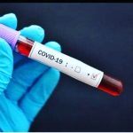 Kasus Positif Covid-19 di Aceh Selatan Bertambah Mencapai 15 Orang