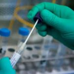 Sejumlah Tenaga Medis Kontak Erat Diupayakan Pemeriksaan Mandiri Di Lab Unsyiah