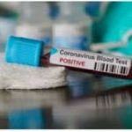 Dampak Bertambahnya Kasus Positif Covid-19 di Aceh Selatan, Berbagai Pihak Mulai Khawatir