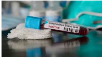 Dampak Bertambahnya Kasus Positif Covid-19 di Aceh Selatan, Berbagai Pihak Mulai Khawatir