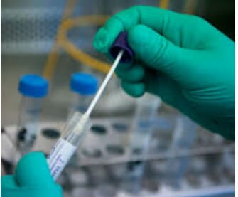 Hasil Swab Mandiri di Unsyiah Bertambah 9 Positif Covid-19 Asal Aceh Selatan