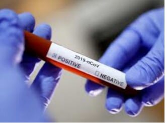 Keluarga Dari Pasien yang Meninggal Dunia Diduga Suspek Covid-19 di Aceh Selatan Pertanyakan Hasil Swab