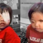 Alami Kanker Mata, Zainatun Nisa Harapkan Uluran Tangan Pemkab Aceh Selatan