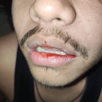 Karena Persoalan Parkir, Oknum TNI di Duga Aniaya Pelanggan Mie Gacoan  di Banda Aceh